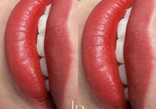 KHÓA HỌC KỸ THUẬT ĐI SỢI – KIM 1RL & 3RL